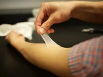 Buscan crear piel artificial para cicatrizar quemaduras graves