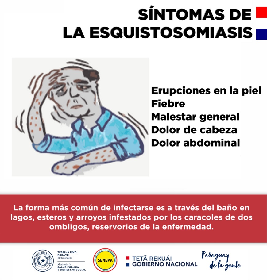 Diario HOY | ¿Qué es la Esquistosomiasis y cómo se transmite?