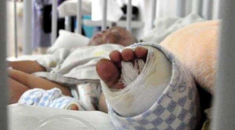 Garrafa explotó e inició incendio: Niña de 5 y su madre, con quemaduras