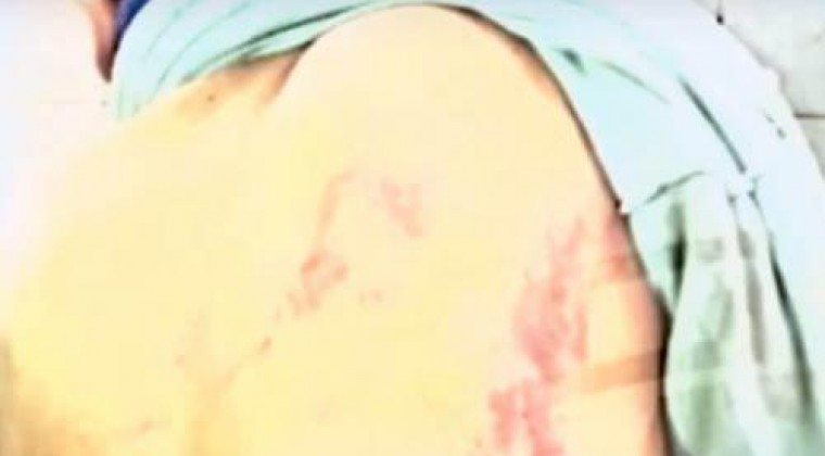 Niño de 10 años golpeado con arreador por el padre de su tutor