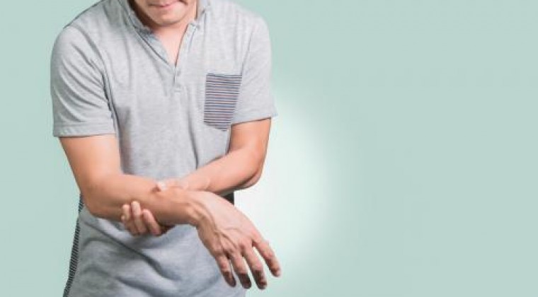 Síndrome de Guillain-Barré tras tener zika: puede dejar secuelas y ser letal