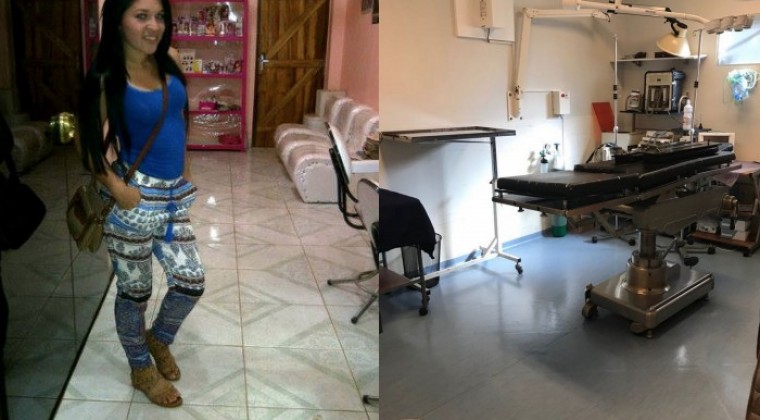 Cirujanos plásticos piden no “satanizar” a la liposucción tras muerte de joven