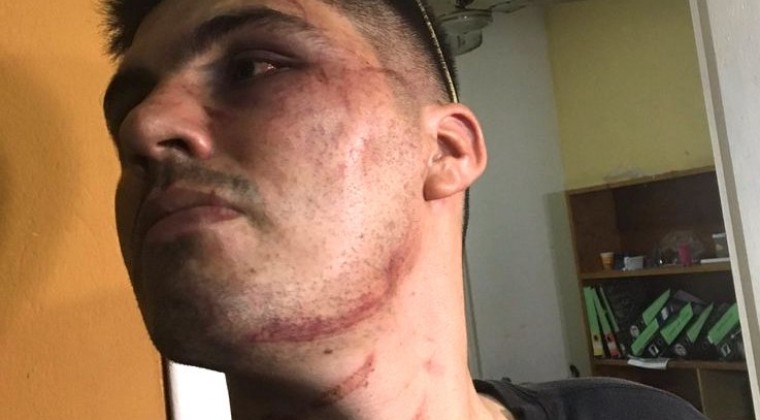 Joven que denunció a policías evitó declarar ante fiscal: “Estaba ebrio e intentó huir”