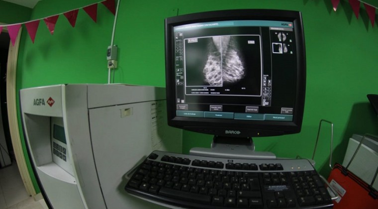 21 mamógrafos están operativos en todo el país, faltan profesionales para instalar más equipos