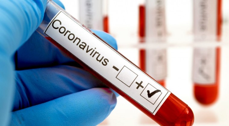 Contaminación de muestras o error de etiquetas, posibilidades en cualquier laboratorio