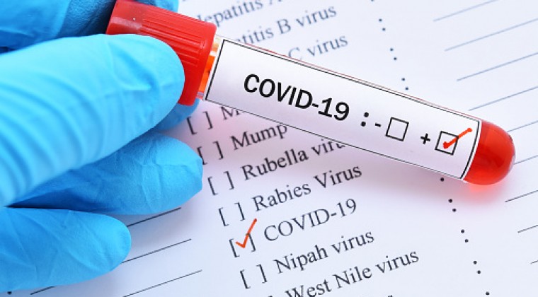 Capiatá: Disponen cierre temporal en sede de la ANDE por casos de COVID-19