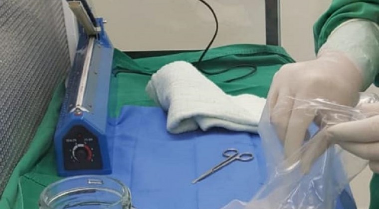 La donación de placenta permite el tratamiento de lesiones producidas por quemaduras