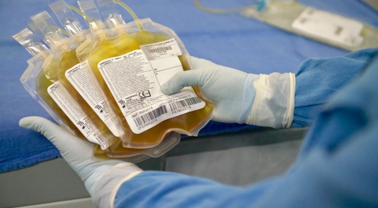 Plasma de convaleciente al inicio del COVID no frena su progresión