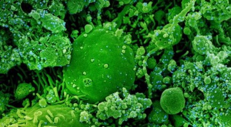 La respuesta de las células T se mantiene ante ómicron, según un estudio