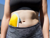 Día del Ostomizado: Salud asiste a más de 1.200 pacientes a nivel país