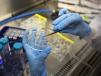 Hallan nueva terapia frente al cáncer de páncreas