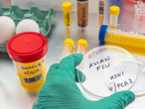 Detectan en España el primer caso de gripe aviar en humanos, el segundo en Europa