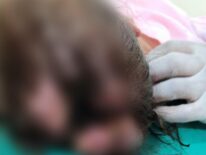 Imputan los padres de la niña con herida agusanada
